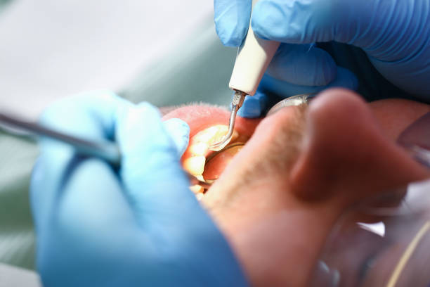 Emergency Gum Pain Relief in SC